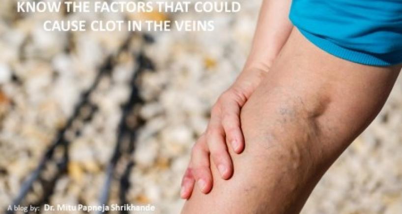 Know The Factors That Could Cause Clot In The Veins